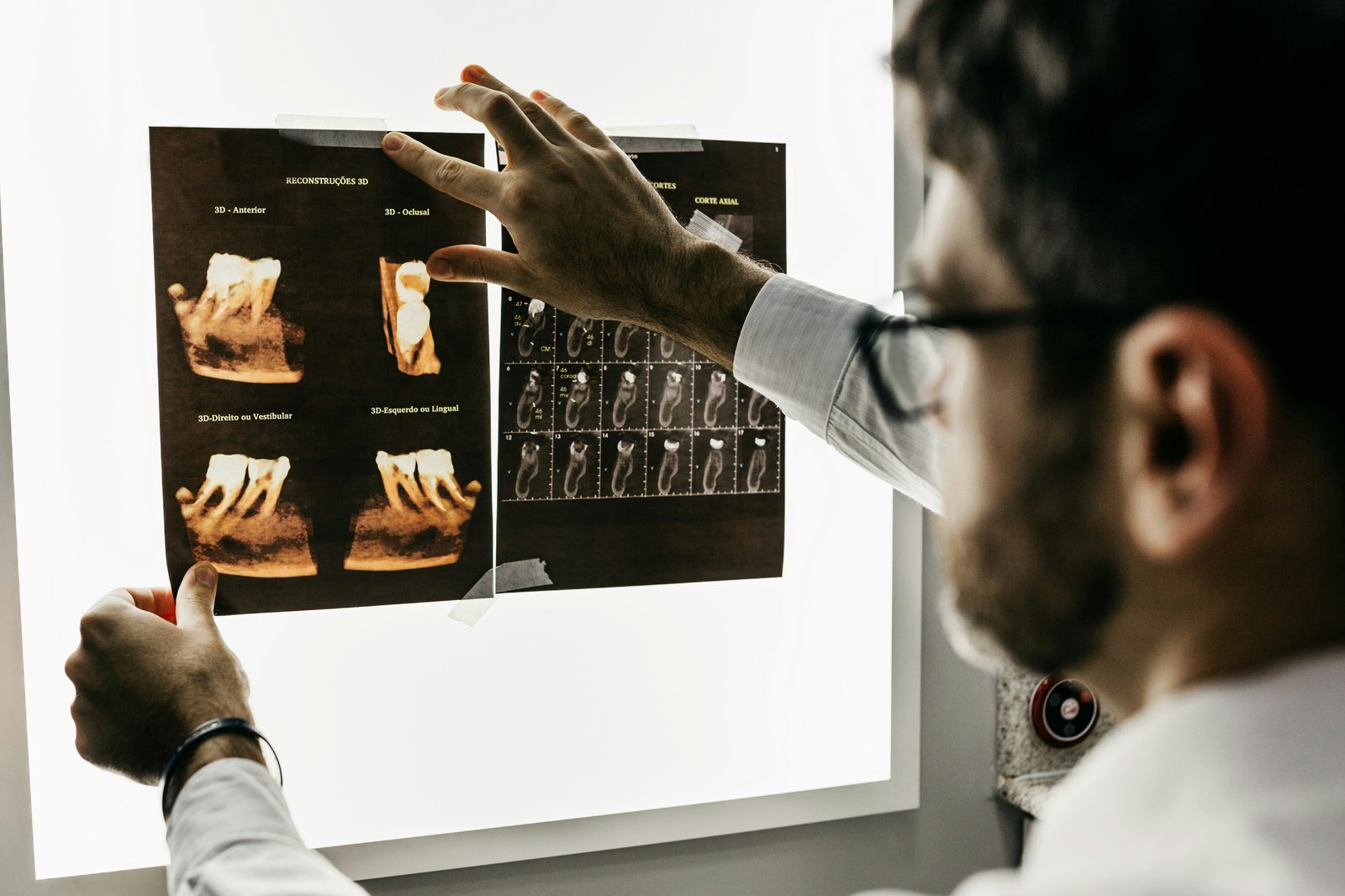Clinician reviewing dental radiographs on a lightbox